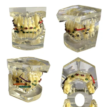 1 Gabalas Skaidrūs Dantų Dantų Ortodontinis Modelis Engle Modelių Mokymo Modelį Odontologijos Medžiagos, Stomatologas Įrankiai