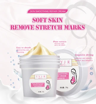 35G Veiksmingai Remonto Strijų Šalinimo Valiklis, Augalų, Gamtos Išgydyti Nėštumo Krūties Klubo Kojos Stretch Mark Cream