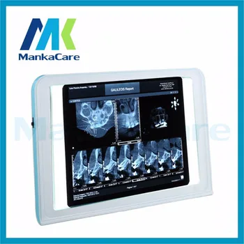 Odontologijos Klinika X-Ray Filmų Apšvietimas Šviesos Lange Xray Viewer Šviesos Skydelio Ekraną, Stomatologija, Laboratoriniai Reikmenys, medicinos negatoscope