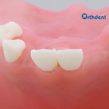 Dantų implantai modelis Dantų praktikuojančių modelis Sinuso pakėlimo praktikos modelis 1pc