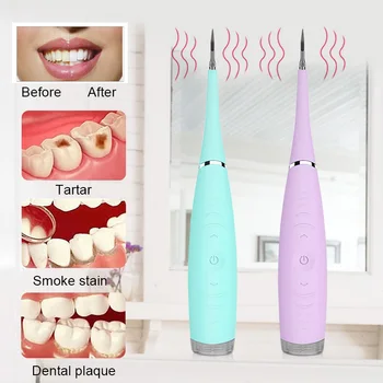 Elektros ultragarsinis dantų švaresnis ultragarsinis dantų švaresnis dantų mastelio šalinimo priemonė dantų balinimo agentas