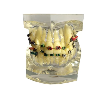 1 Gabalas Skaidrūs Dantų Dantų Ortodontinis Modelis Engle Modelių Mokymo Modelį Odontologijos Medžiagos, Stomatologas Įrankiai