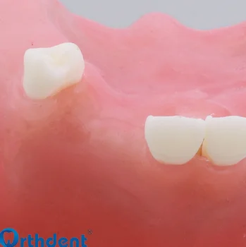 Dantų implantai modelis Dantų praktikuojančių modelis Sinuso pakėlimo praktikos modelis 1pc