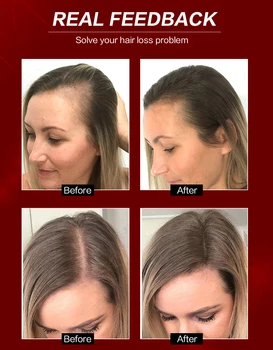 Plaukų Augimo Esmė Purškimo eterinis Aliejus Skystas Vyrų, Moterų Sausų Plaukų atgaivinimo Remonto Plaukų Priežiūra Stabdžių Plaukų Slinkimas Produktų
